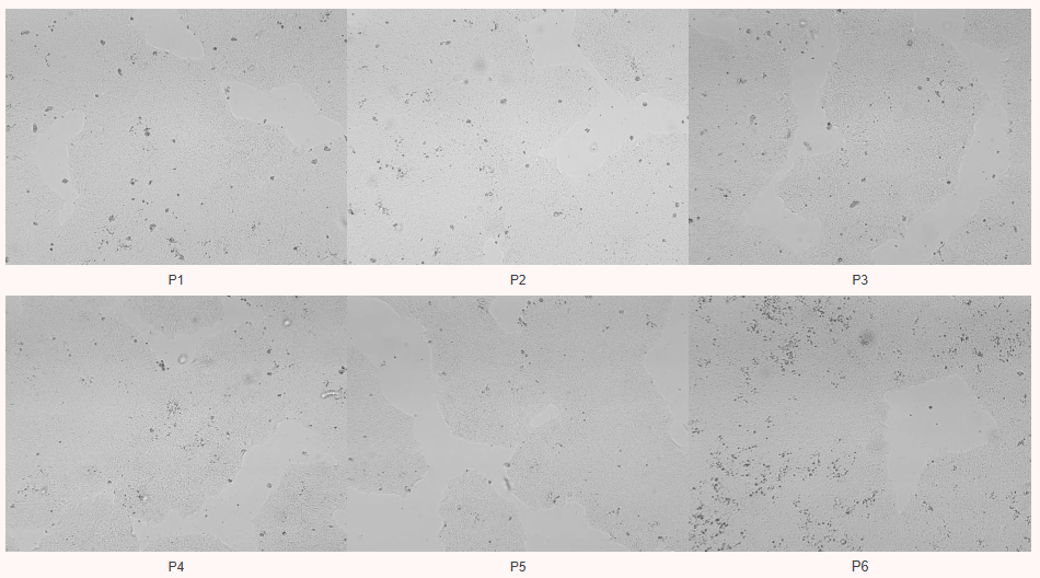 a902b3ca8098bbac9956184d5f619195.png